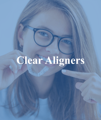 Clear Aligners (1)