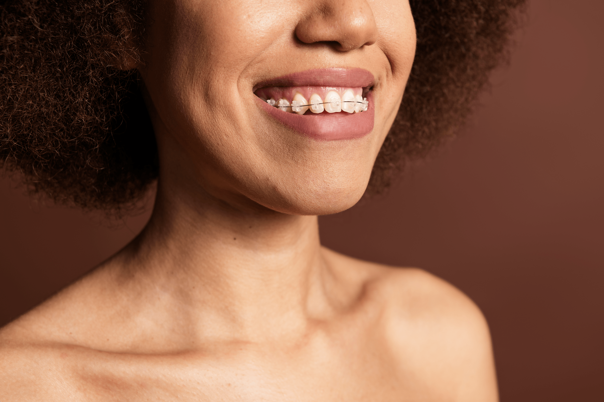 girl wearing metal braces
